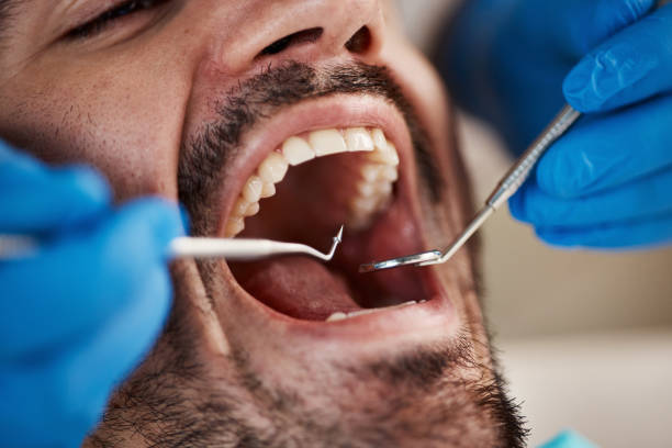 TMJ/TMD Treatment in Smithville, OH